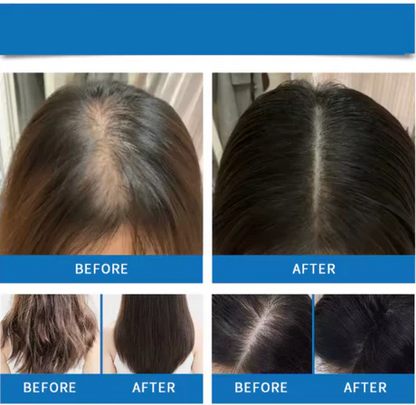 Hair Regrowth Roll-On Serum Treatment